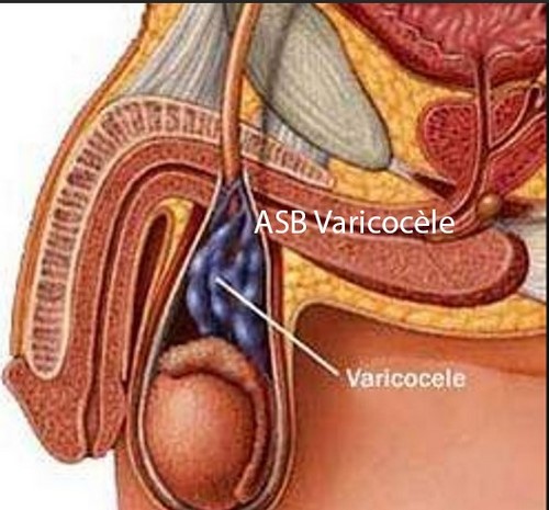 L'Andropause Causes Traitements Naturels