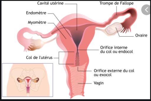 Endométriose Causes Traitement Naturel .Vaincre l'Endométriose Naturellement