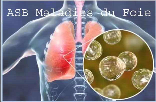 Fibrose Pulmonaire Traitement Naturel Soigner Naturellement La Fibrose Pulmonaire