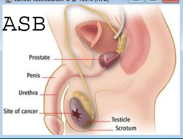 Prostate Causes Symptômes Traitements Naturels. Plantes pour soigner la Prostate.