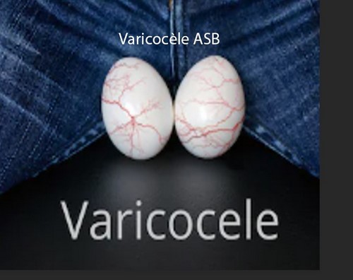 Varicocèle Causes Traitement Naturel . Soignez Naturellement la Varicocèle avec les Plantes