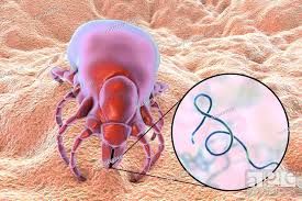 Maladie de Lyme Solution Naturelle