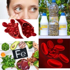 Baume de Nerfs pour Soigner la Drépanocytose