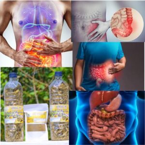 Remède pour Guérir le Syndrome du Côlon Irritable