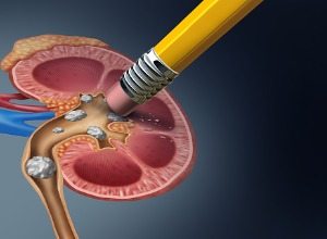 Lithiase Rénale Causes Symptômes Traitement Naturel