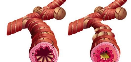 Solution Naturelle contre L'Asthme