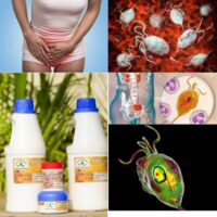 Remède pour soigner le Trichomonas vaginalis