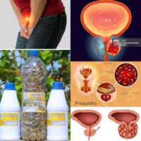 Tisane pour Soigner la Prostatite