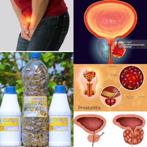 Tisane pour Soigner la Prostatite