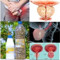 Remède Naturel Contre le Cancer de la Prostate