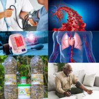 Remède pour soigner la Thrombose Veineuse