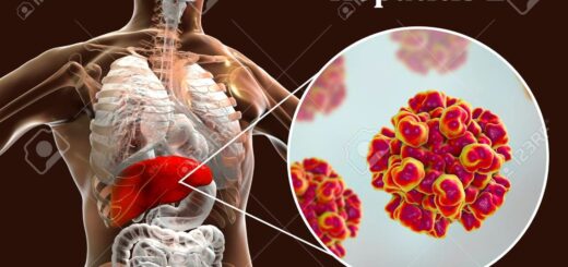 Hépatite B Causes Symptômes Complications Thérapie Naturelle