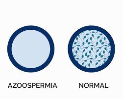 Azoospermie Solution Naturelle