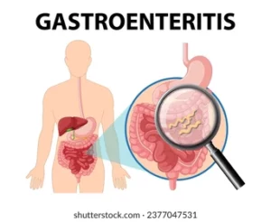 Gastro-entérite Causes Symptômes Prévention Traitement Naturel
