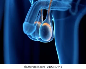 Kyste Testiculaire Causes Symptômes Thérapie Naturelle