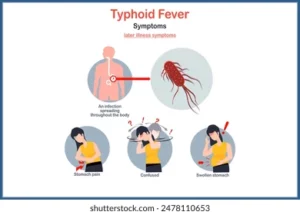 Fièvre Typhoïde Solution Naturelle