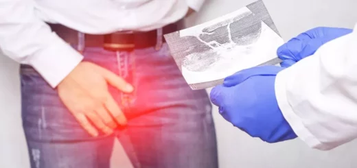 Comment Soigner Naturellement une Kyste Épididymite en peu de Temps ?